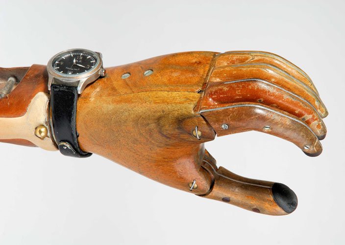 Unterarmprothese des Tegernseer Hutmachers Friedl Schätz (Foto: Michael Kowalski, Ausschnitt) © Deutsches Medizinhistorisches Museum Ingolstadt